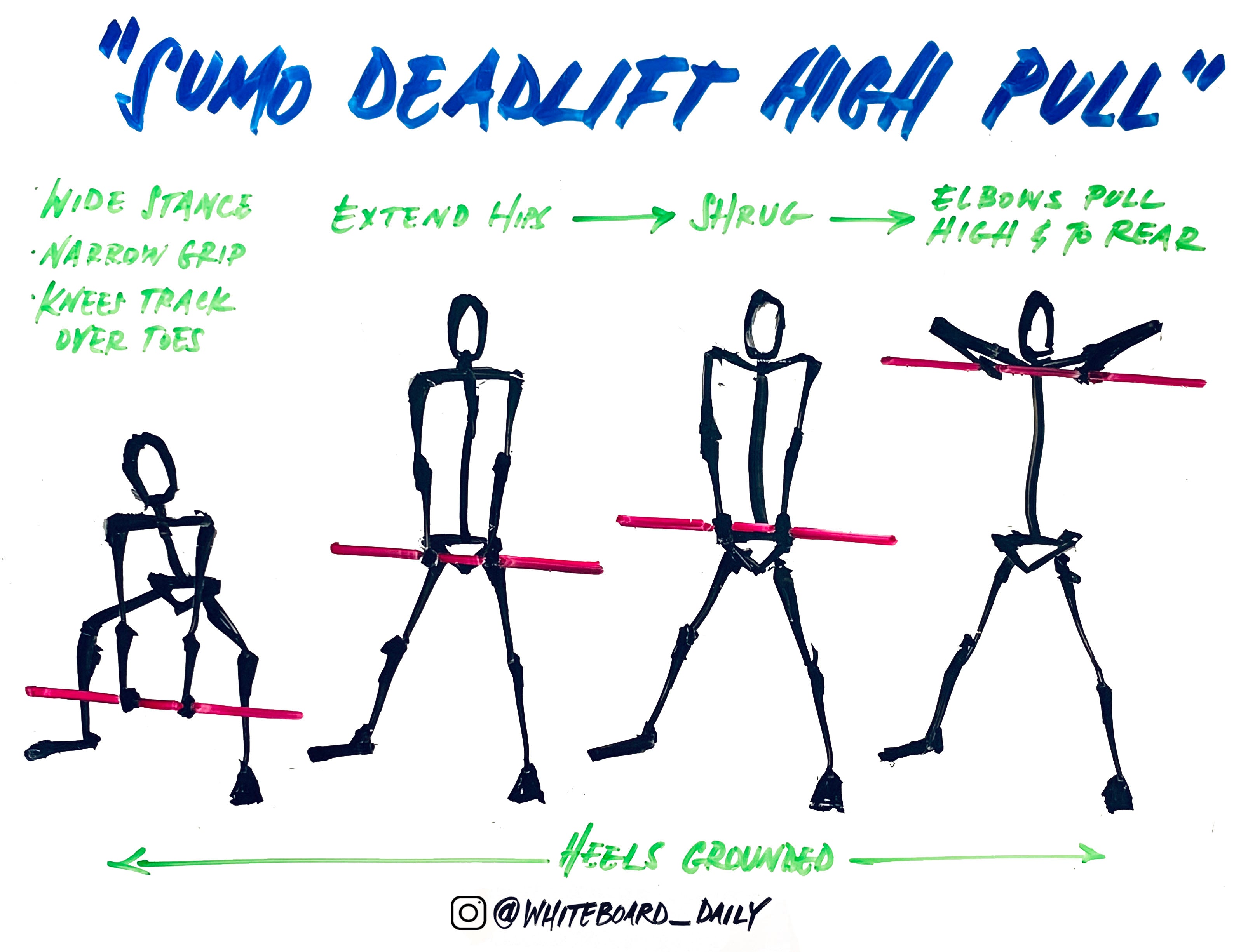 The Sumo Deadlift High Pull  The sumo deadlift high pull builds on the  deadlift but uses a wider stance and a narrower grip. The sumo deadlift  high pull also adds velocity